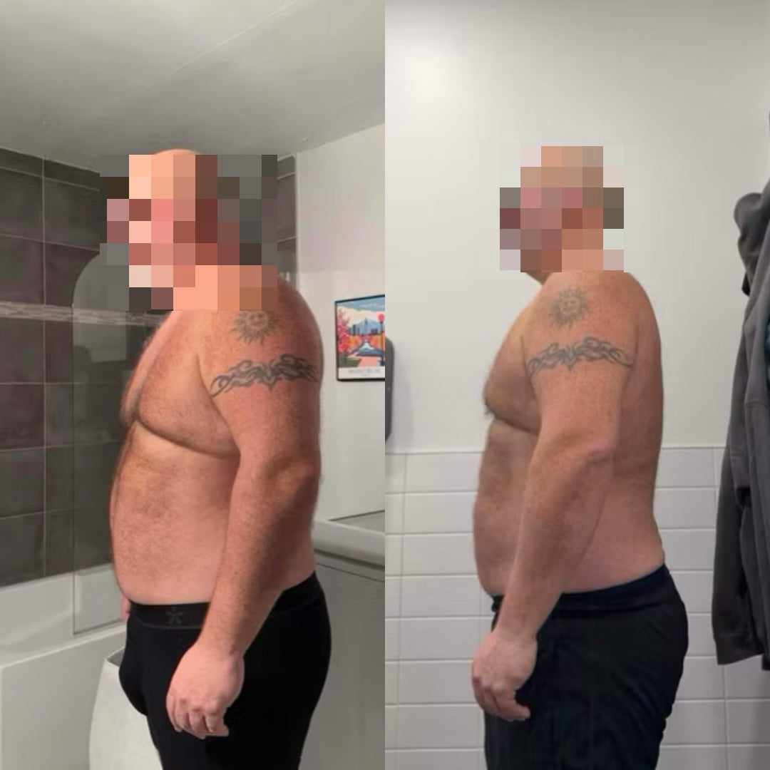 Patrick .L transformation